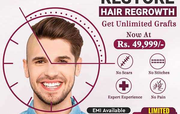 Hair Transplantation Treatment in Hyderabad