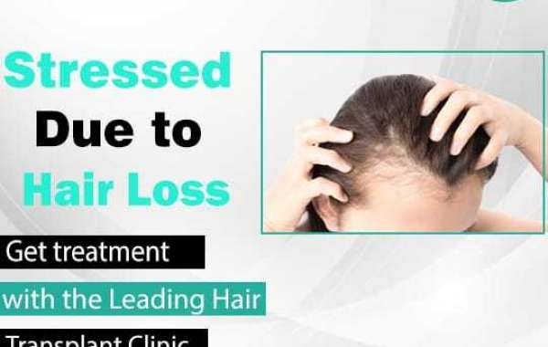 Best hair transplant treatment in delhi